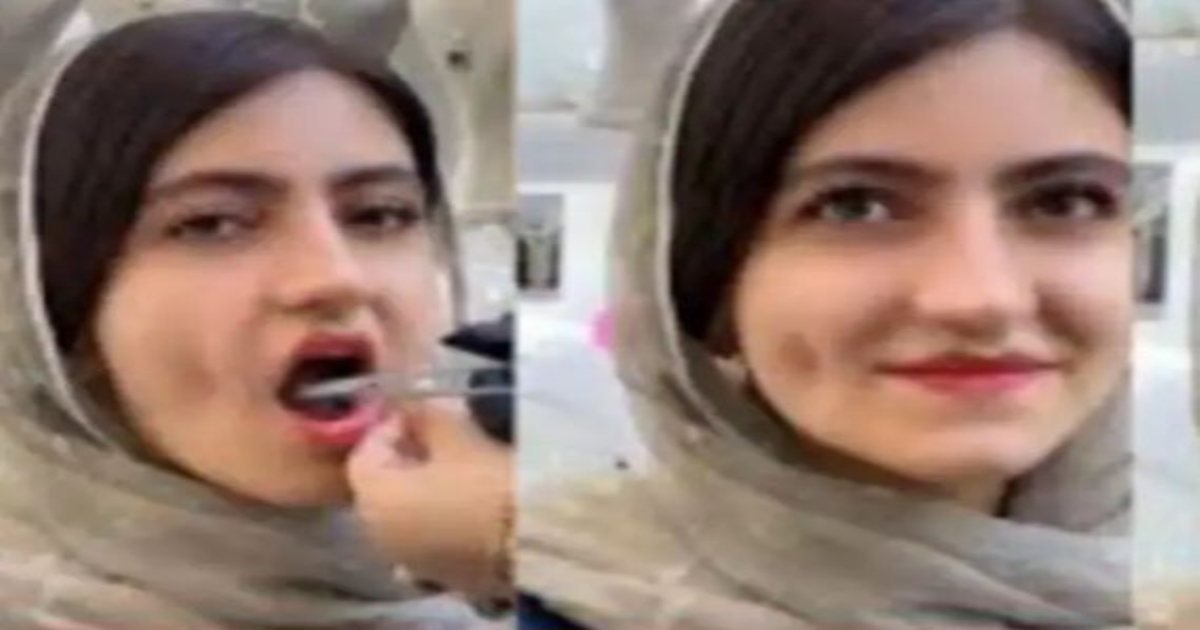 woman-dimpleplasty-viral-video