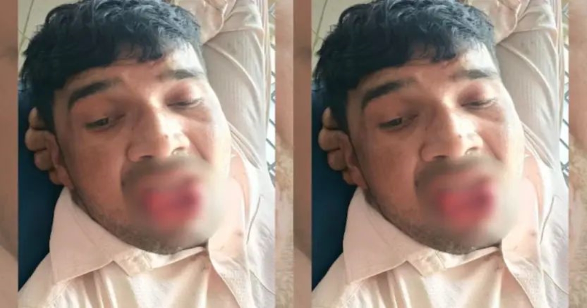 kanpur-woman-fights-back-sexual-assault