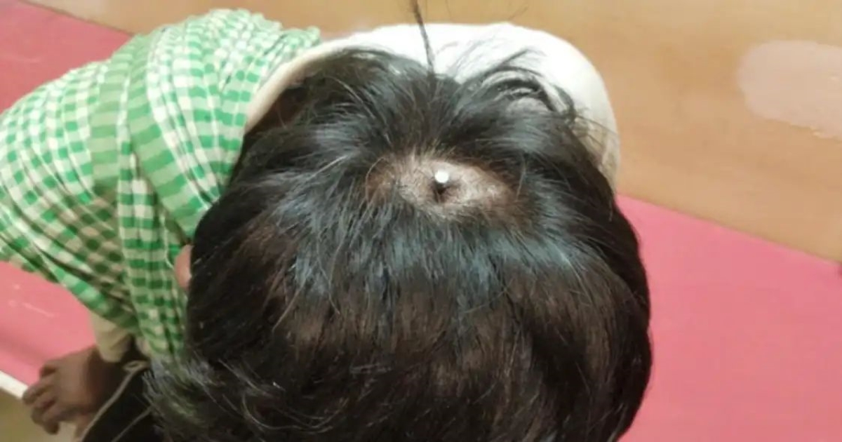 uttar-pradesh-firozabad-nail-attack-son-shocking-incide