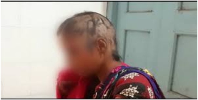 Husband shaved wife head for illegal affiar