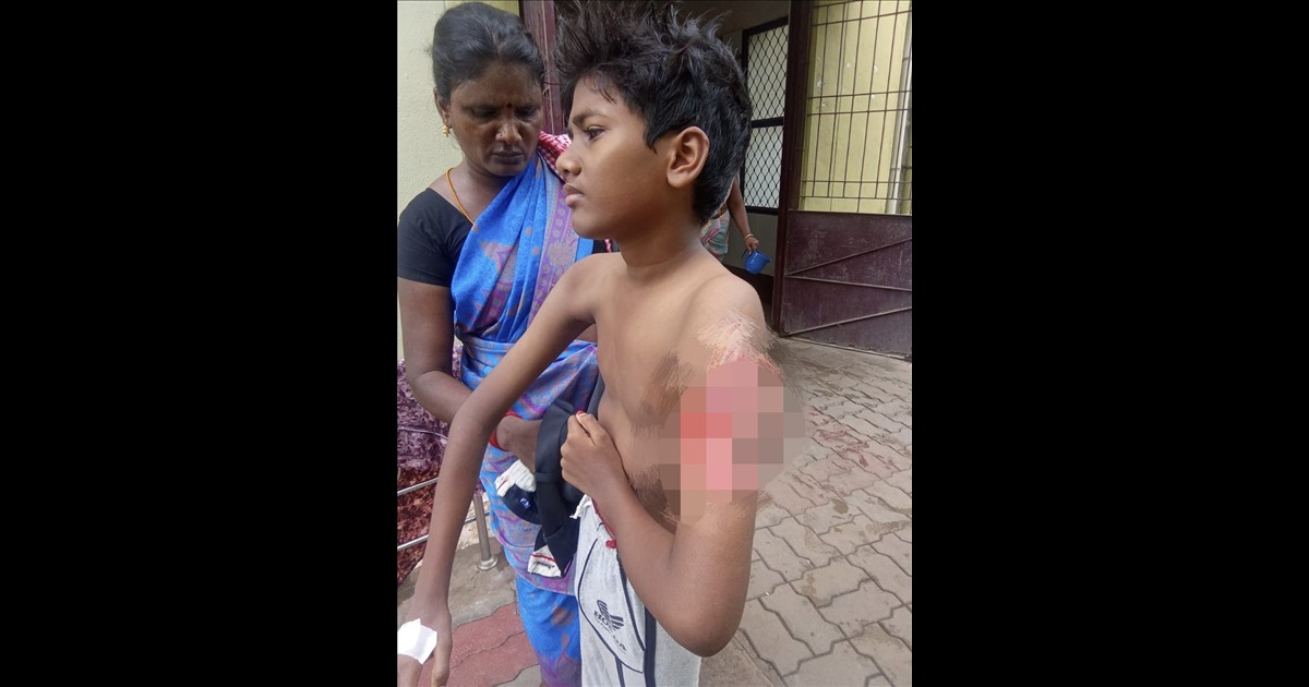 in-perambalur-minor-boy-affected-injection-issue-surger