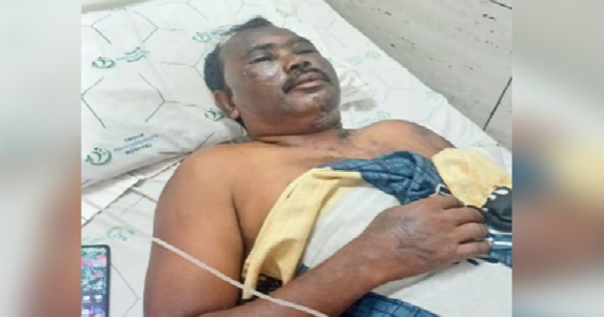 Tiruvarur Shocker: Teacher Attacked With Acid Amid Sexual Harassment Probe