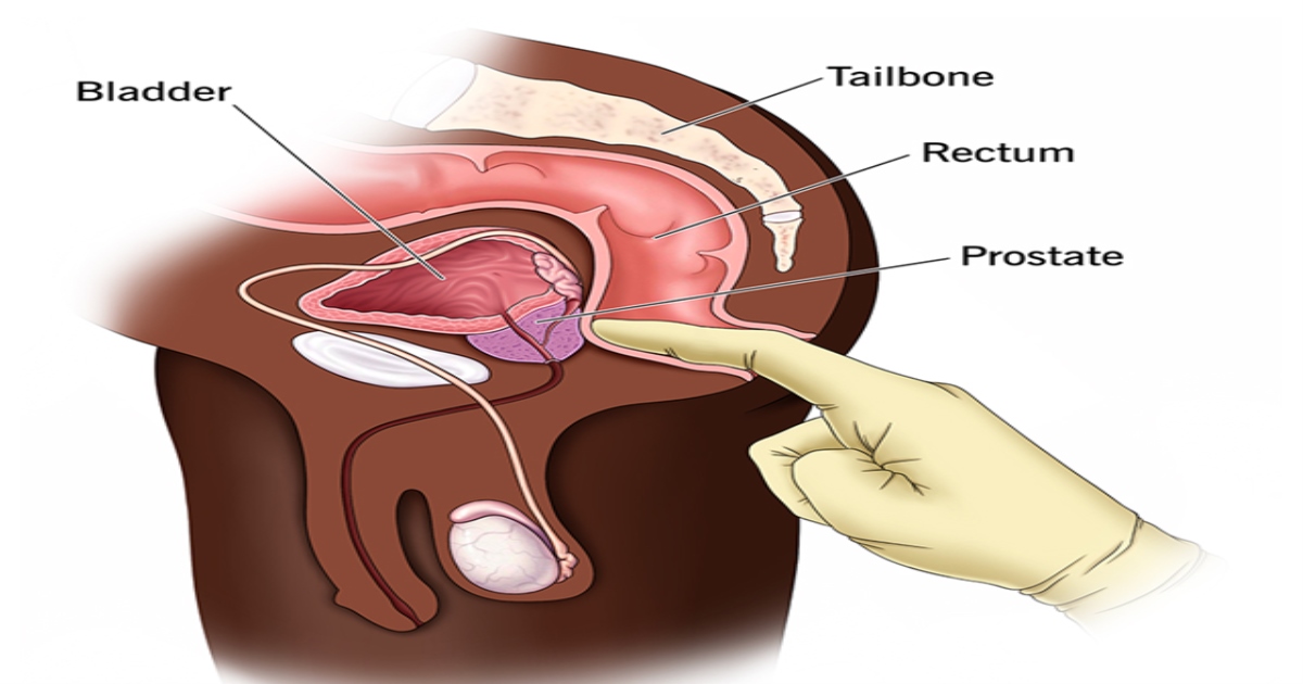 Prostate