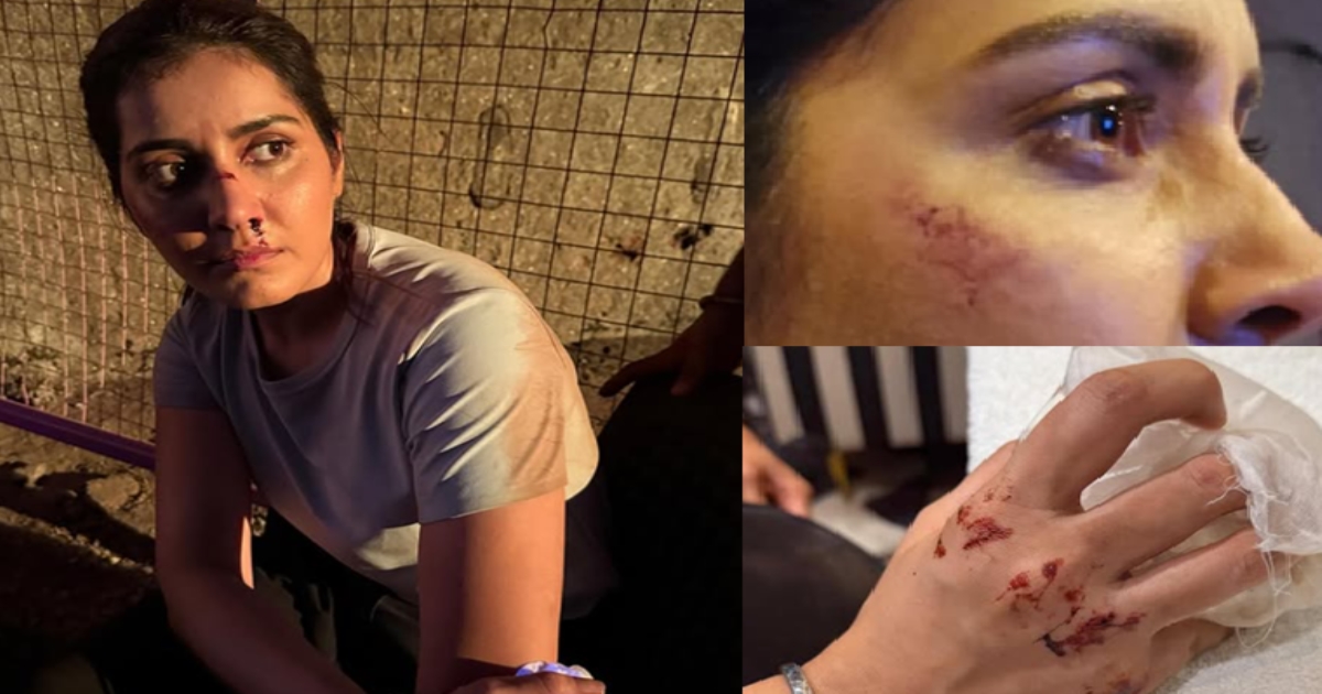 Tamil Actress Rashi kanna share bloodscene photos in instagram