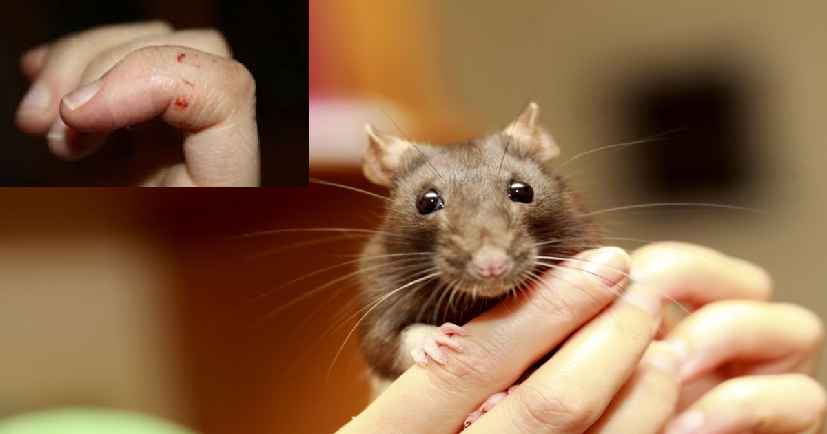 rat-bite-danger-doctors-warn-against-ignoring-symptoms