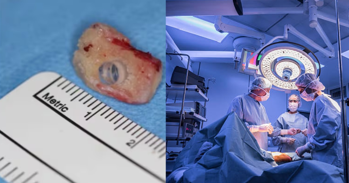 canada women getting view using teeth cells