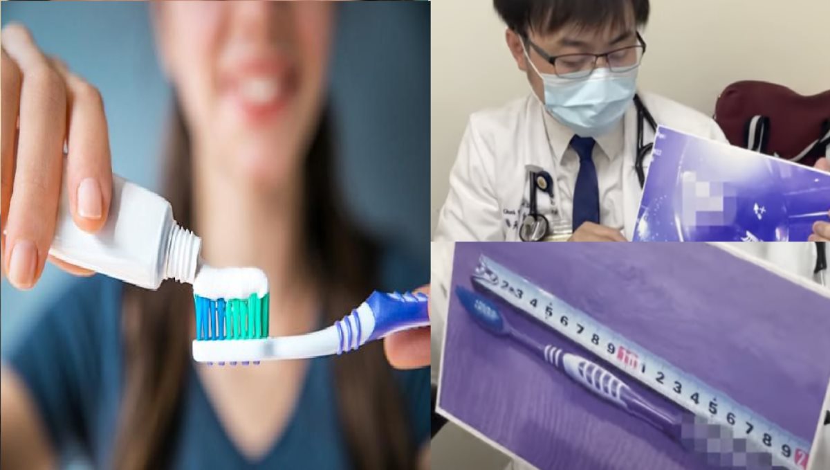 taiwan-woman-sallow-tooth-brush-doctors-removed-after-7