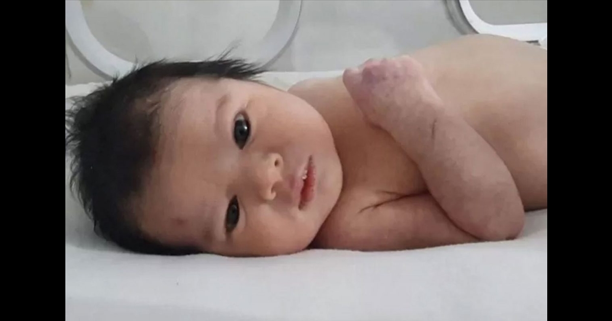 lost parents in earthquake; People competing to adopt baby "Aya"...