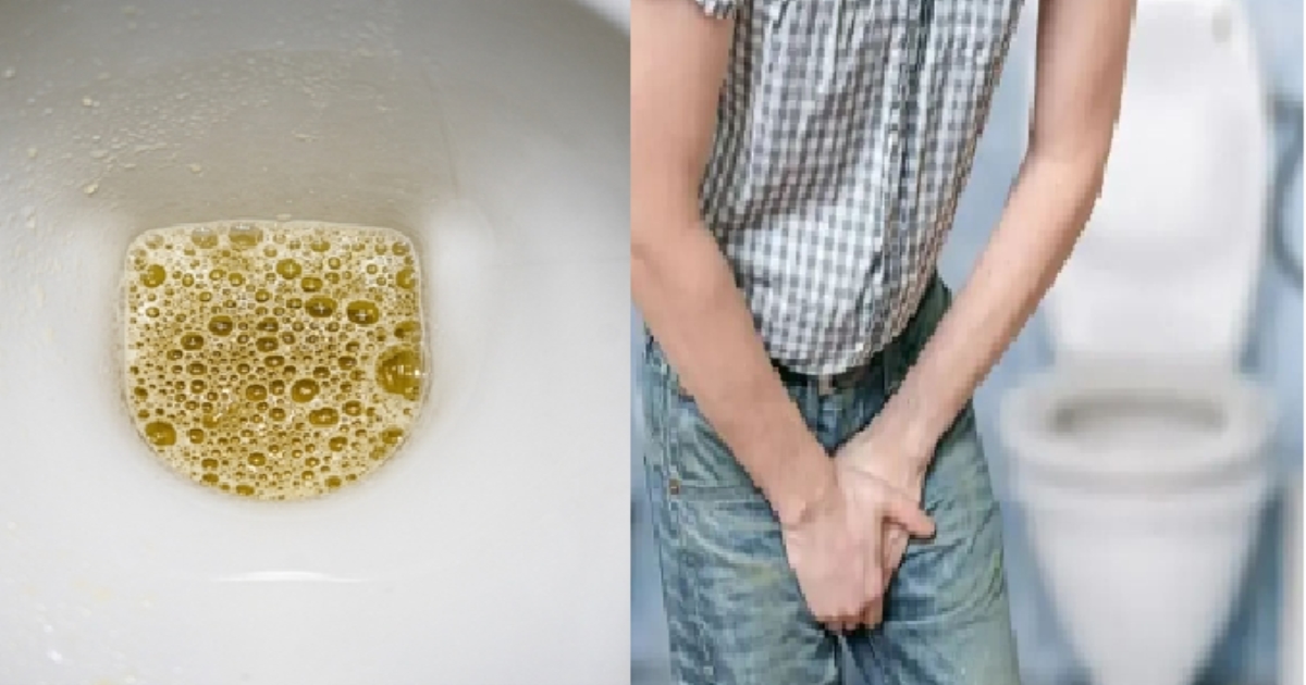 Foamy Urine May Signal Kidney Disease