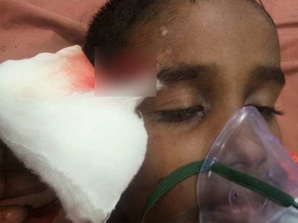 2 rowdies in alcohol injured 7 year old boy in che