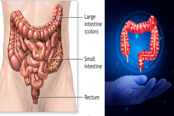 பெருங்குடல் புற்றுநோய்