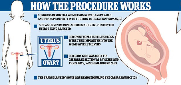 Womb transplant