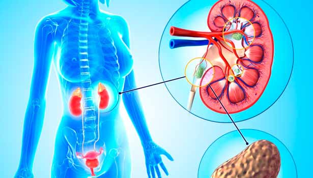 Urinary tract infections