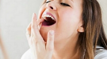 home-remedies-for-tooth-pain