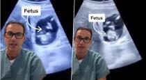 Fetus grow on mother liver