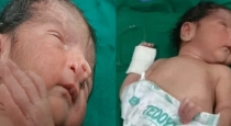 woman-gives-a-birth-to-a-miracle-child-many-people-come