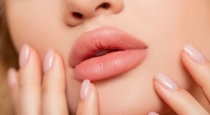 want-cherry-like-lips-try-these-tips