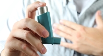 foods-asthma-patients-must-avoid