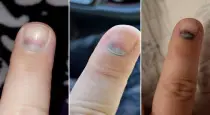 Nail-color-health-warning-signs