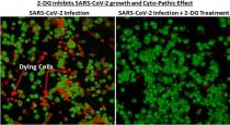 DRDOs 2-DG drug for treatment of Covid patients