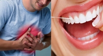 link-between-heart-attack-and-oral-hygiene-doctors-shar