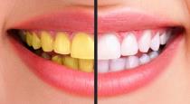 how-to-use-baking-soda-and-coconut-oil-for-white-teeth