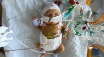 premature-baby-born-at-just-23-weeks-in-lockdown-was-sm