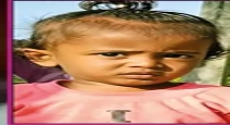 in Chengalpattu 1 Year Old Baby Dies 