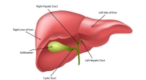 causes-of-liver-damage-and-how-clean-it-naturally