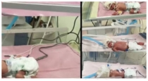 Australia-rare-identical-quadruplet-girls-birth