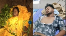 Agra-snake-bite-siblings-girl-dies