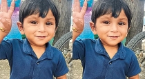 Andhra-pradesh-two-year-old-dies-of-rabies-after-stray-