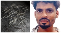 ramanathapuram-chain-snatching-accused-swallowed-pins