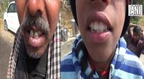 Bihar Villagers Affected Teeth Problem Drinks Fluoride Mixing Water 