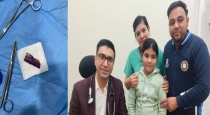 Delhi Girl Eat Chocolate with Cover Doctors remove It 