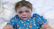 america-texas-7-aged-child-boy-conner-landers-attacked