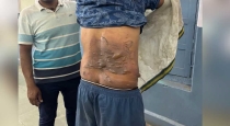 Woman-attacks-husband-hot-oil-bhavani-mandi