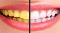 Simple tips for clean the yellow teeth 