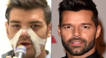 Facial surgery to look like an actor