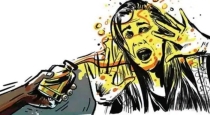 Women attacked by acid in assam