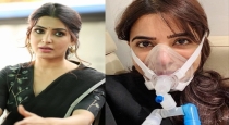 actress-samantha-surgery