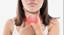 Remedies to cure thyroid 