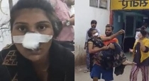 in Uttar Pradesh Harodi Husband Cut off Wife Nose 