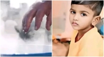   in Telangana Hyderabad 4 Year Old Baby Dies hot Water 