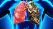 Natural herbs for Lungs