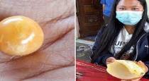 woman-finds-orange-melo-pearl-worth-crores-of-rupees-in