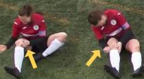 Women football player makes her dislocated knee back video