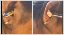Snake-in-ear-viral-video