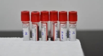 Rare-blood-group-guadeloupe-negative-discovery