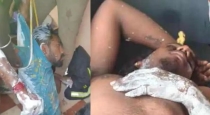 Dindigul-water-tank-painting-workers-faint
